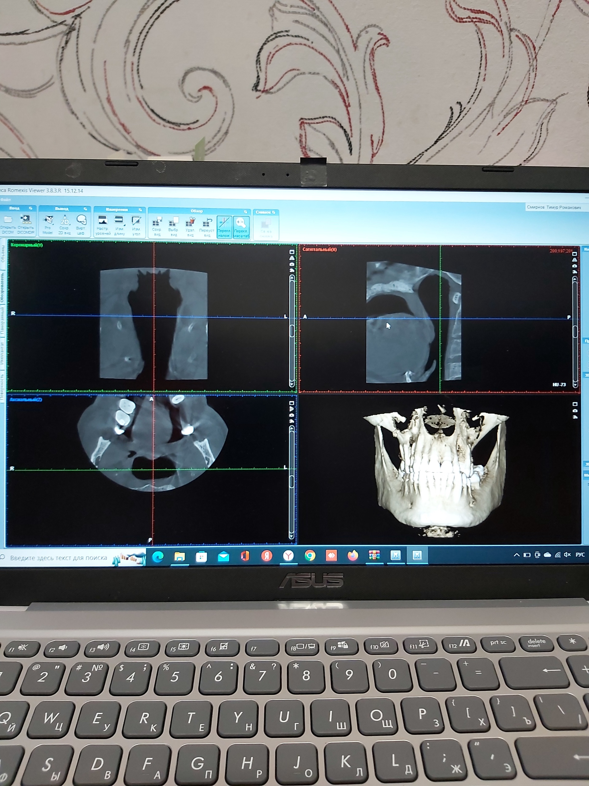 Кабинет рентгена и 3D-диагностики, улица Мира, 4Б, Нижневартовск — 2ГИС