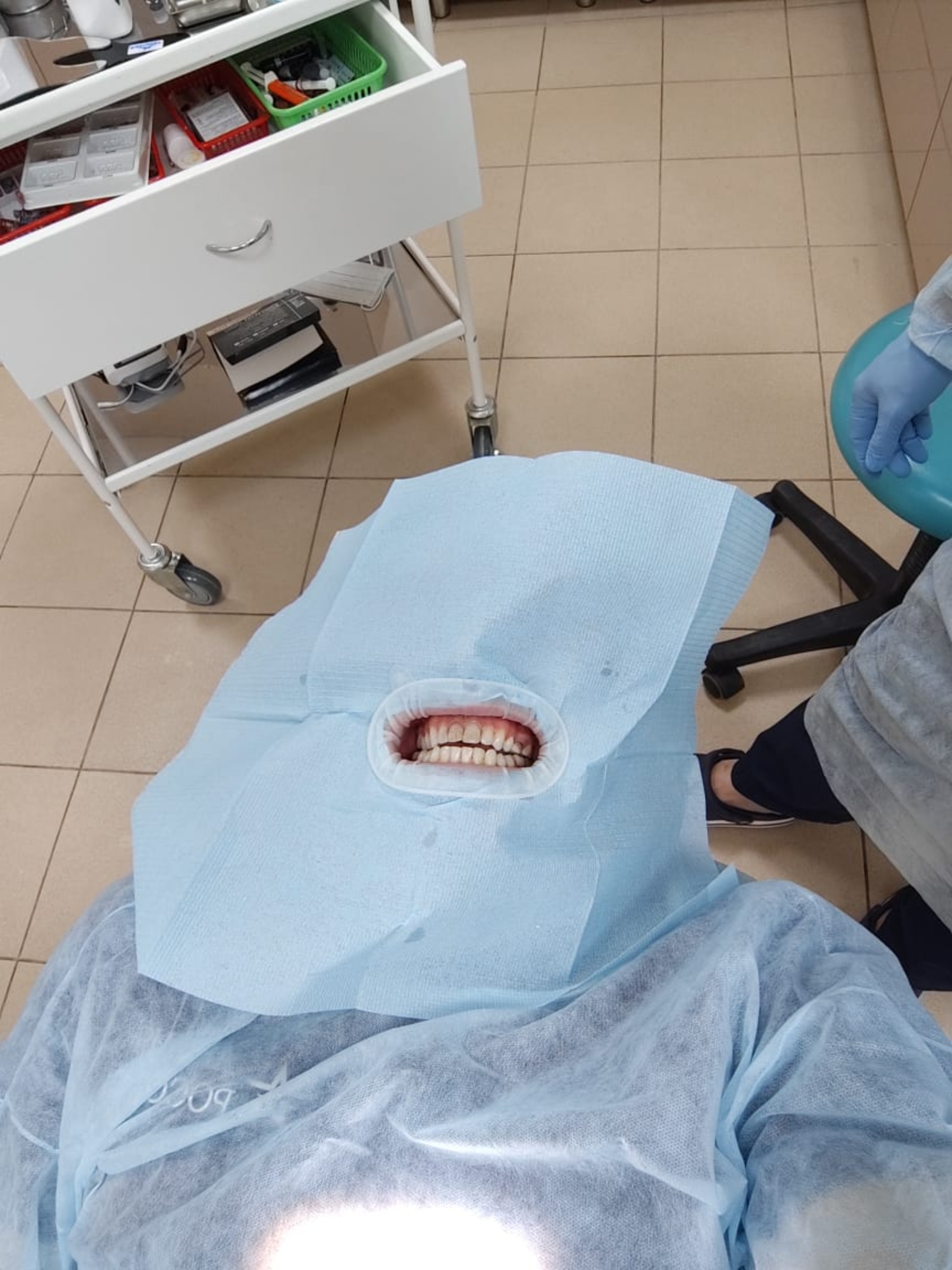 OssDental, Астраханская улица, 51в, с. Осыпной Бугор — 2ГИС