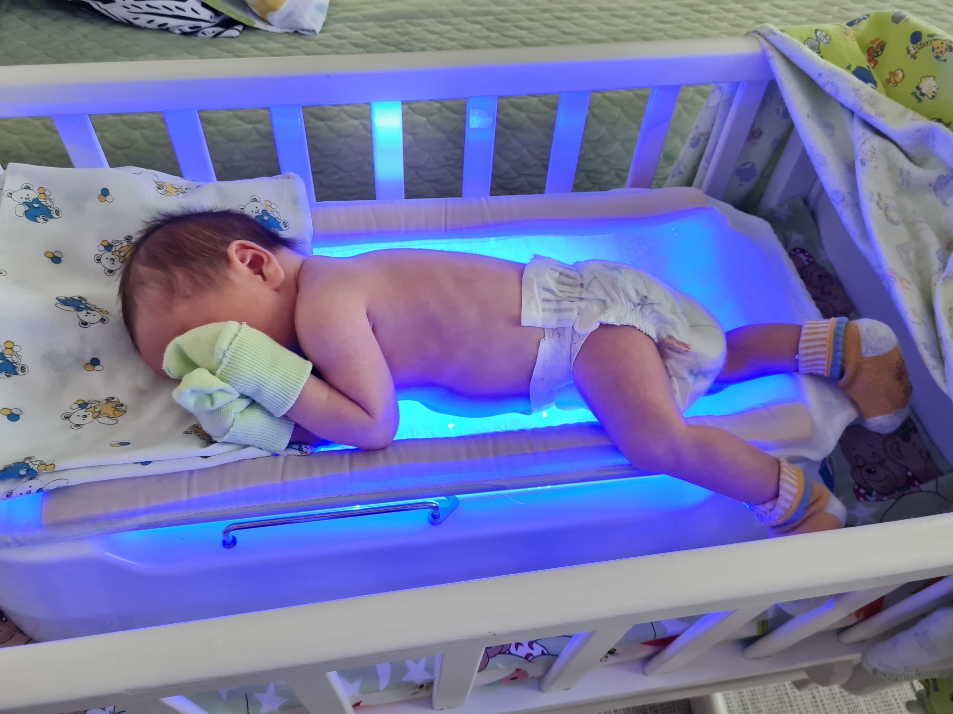 Как правильно лежать под лампой при желтушке новорожденных дома.