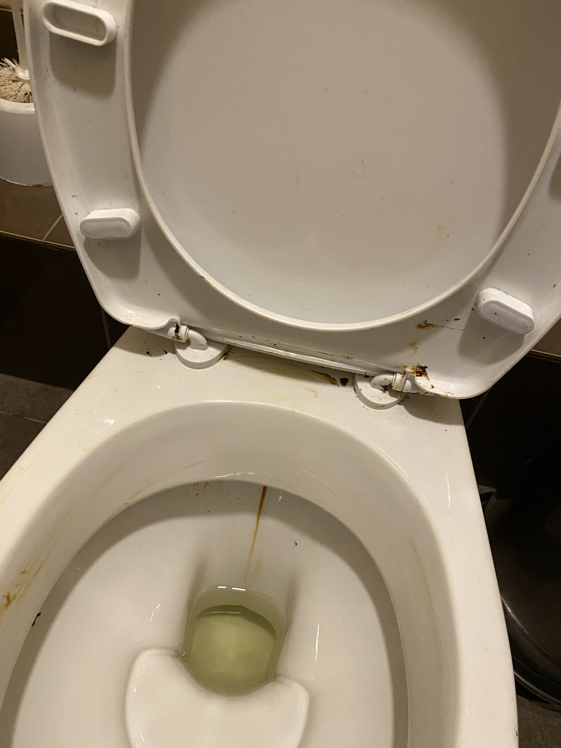 what does amniotic fluid look like in toilet